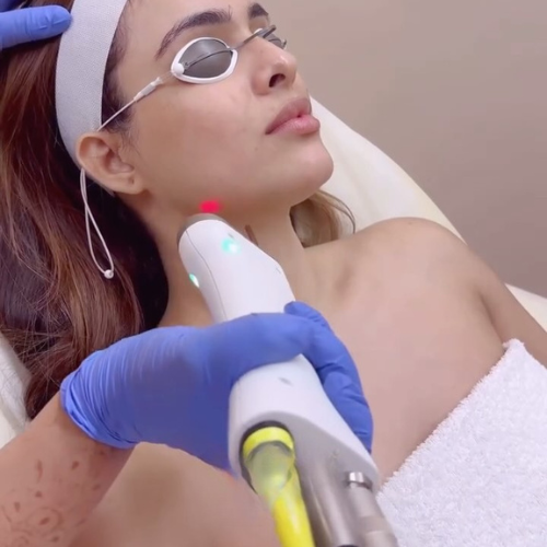 Laser Hair Removal: How it Works, Safety & What to Expect