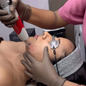 Is laser hair removal permanent