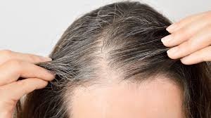 Causes for hair loss and best treatments