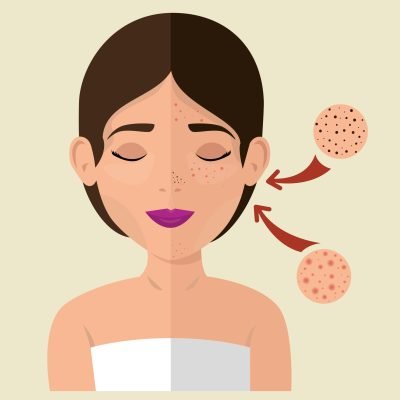 beautiful woman in treatment facial vector illustration design